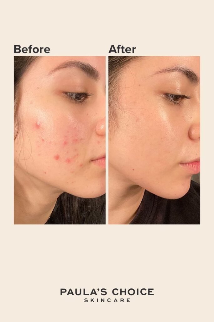 Pure vivid skin transformation